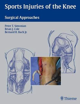 Sports Injuries of the Knee