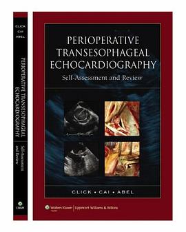 Perioperative Transesophageal Echocardiography Self-Assessment and Review pdf epub mobi 电子书 下载