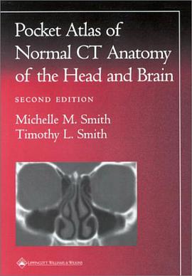 Pocket Atlas of Normal CT Anatomy of the Head and Brain pdf epub mobi 電子書 下載