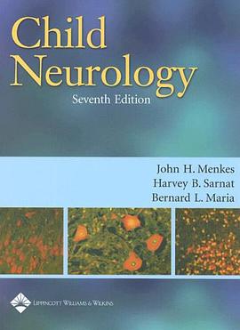 Child Neurology pdf epub mobi 电子书 下载