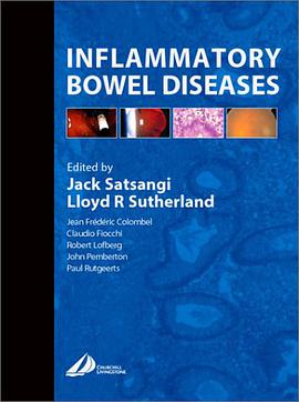 Inflammatory Bowel Diseases pdf epub mobi 电子书 下载
