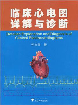 临床心电图详解与诊断