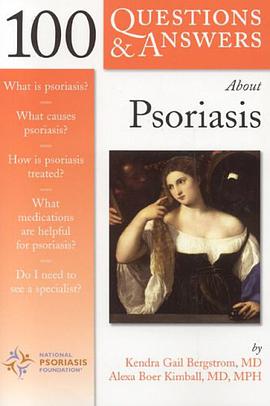 100 Questions and Answers About Psoriasis pdf epub mobi 电子书 下载