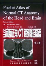 头和脑正常CT解剖袖珍图谱 pdf epub mobi 电子书 下载