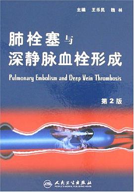 肺栓塞與深靜脈血栓形成 pdf epub mobi 電子書 下載