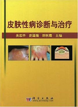皮肤性病诊断与治疗 pdf epub mobi 电子书 下载