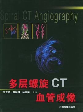 多层螺旋CT血管成像
