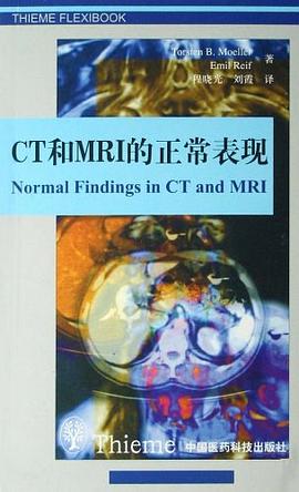 CT和MRI的正常表现 pdf epub mobi 电子书 下载