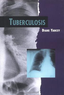 Tuberculosis pdf epub mobi 电子书 下载