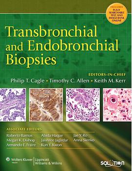 Transbronchial and Endobronchial Biopsies pdf epub mobi 电子书 下载
