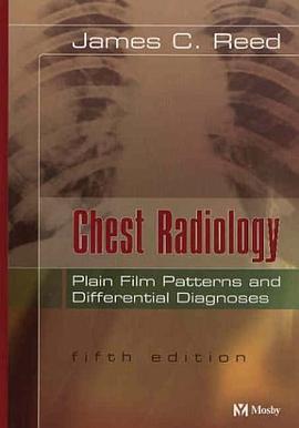 Chest Radiology -- Plain Film Patterns and Differential Diagnoses pdf epub mobi 电子书 下载
