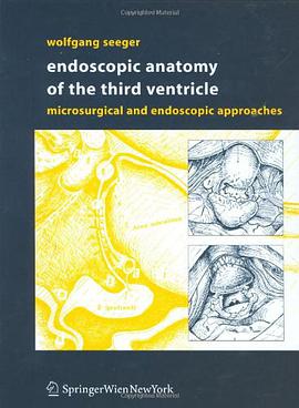 Endoscopic Anatomy of the Third Ventricle pdf epub mobi 电子书 下载