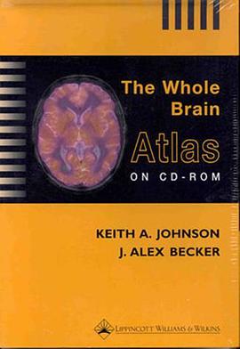 The Whole Brain Atlas pdf epub mobi 电子书 下载