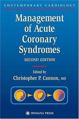 Management of Acute Coronary Syndromes pdf epub mobi 电子书 下载
