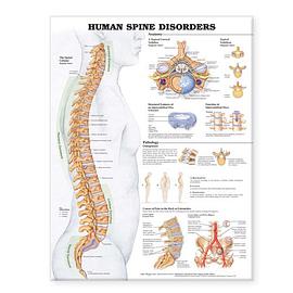 Human Spine Disorders Anatomical Chart pdf epub mobi 电子书 下载