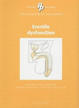 Patient Pictures Erectile Dysfunction pdf epub mobi 电子书 下载