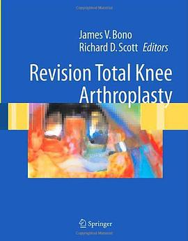 Revision Total Knee Arthroplasty pdf epub mobi 电子书 下载