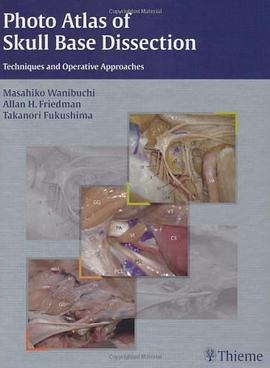 Photo Atlas of Skull Base Dissection pdf epub mobi 电子书 下载