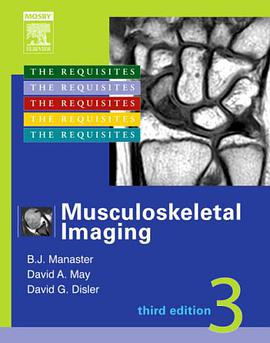 Musculoskeletal Imaging pdf epub mobi 电子书 下载