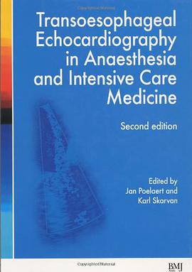 Transoesophageal Echocardiography in Anaesthesia and Intensive Care Medicine pdf epub mobi 电子书 下载