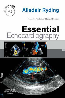 Essential Echocardiography pdf epub mobi 电子书 下载