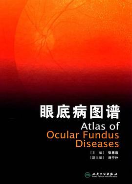 眼底病图谱 pdf epub mobi 电子书 下载