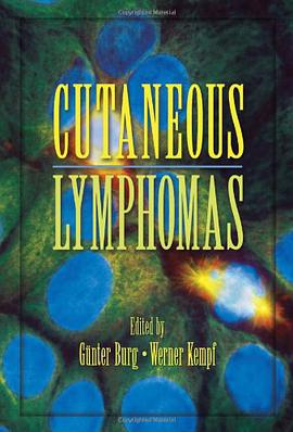 Cutaneous Lymphomas pdf epub mobi 电子书 下载