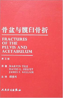 骨盆與髖臼骨摺 pdf epub mobi 電子書 下載