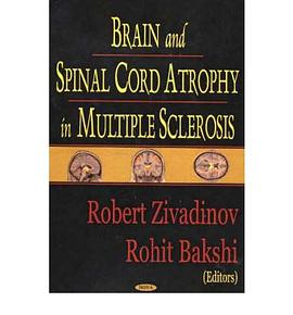 Brain and Spinal Cord Atrophy in Multiple Sclerosis pdf epub mobi 电子书 下载