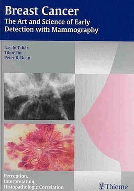 Breast Cancer pdf epub mobi 电子书 下载