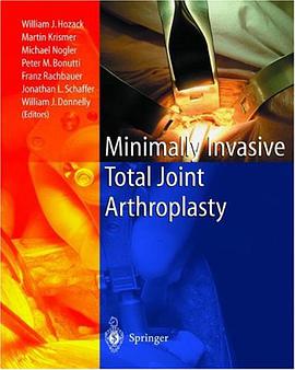 Minimally Invasive Total Joint Arthroplasty pdf epub mobi 电子书 下载