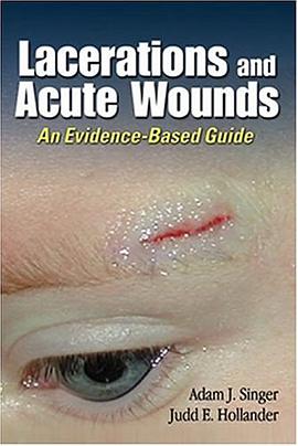 Lacerations and Acute Wounds pdf epub mobi 电子书 下载