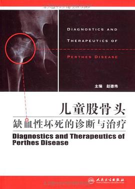 儿童股骨头缺血性坏死诊疗学 pdf epub mobi 电子书 下载