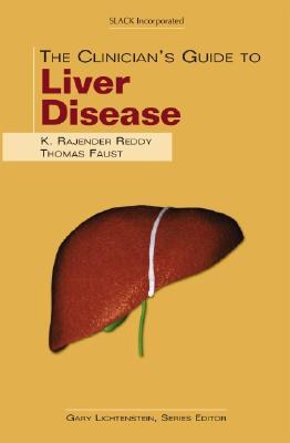 THE CLINICIAN''S GUIDE TO LIVER DISEASE pdf epub mobi 电子书 下载