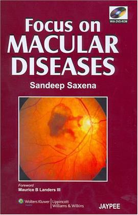 Focus on Macular Diseases pdf epub mobi 电子书 下载