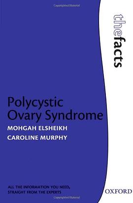 Polycystic Ovary Syndrome pdf epub mobi 电子书 下载