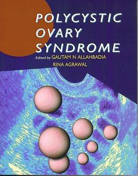 Polycystic Ovary Syndrome pdf epub mobi 电子书 下载