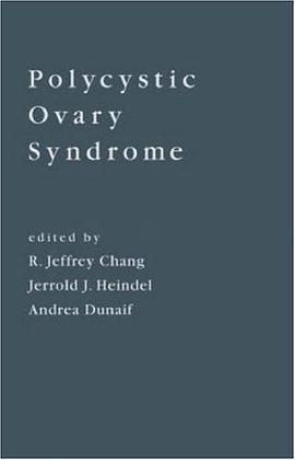 Polycystic Ovary Syndrome pdf epub mobi 电子书 下载