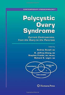 Polycystic Ovary Syndrome pdf epub mobi 电子书 下载
