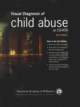 Visual Diagnosis of Child Abuse pdf epub mobi 电子书 下载