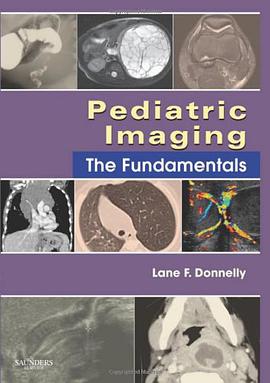 Pediatric Imaging pdf epub mobi 电子书 下载