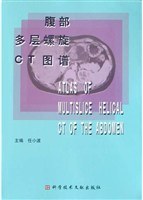 腹部多層螺鏇CT圖譜 pdf epub mobi 電子書 下載