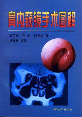 鼻内窥镜手术图解 pdf epub mobi 下载