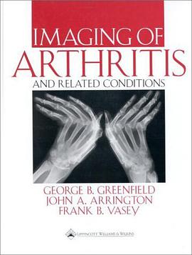 Imaging of Arthritis and Related Conditions