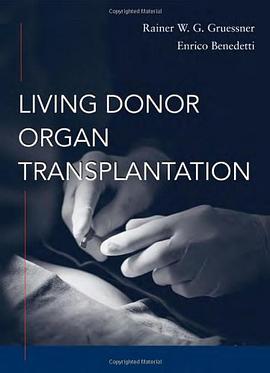 Living Donor Organ Transplantation pdf epub mobi 电子书 下载