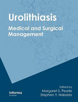 Urolithiasis pdf epub mobi 电子书 下载