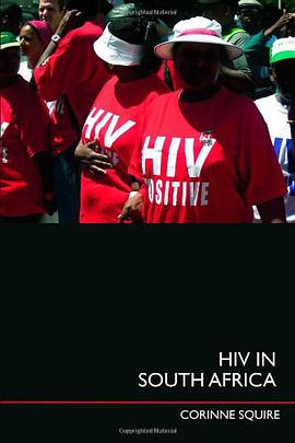 HIV in South Africa pdf epub mobi 电子书 下载