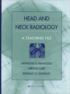 Head and Neck Radiology
