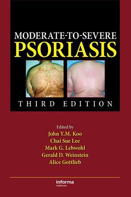 Moderate-to-Severe Psoriasis pdf epub mobi 电子书 下载