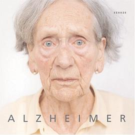 Alzheimer (German Edition) pdf epub mobi 电子书 下载
